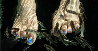 Nach Fisch-Pediküre: Fünf Zehen müssen amputiert werden