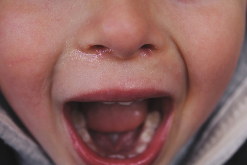 Dieses Bild zeigt ein weinendes Mädchen.
