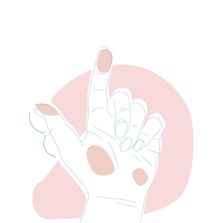 Dieses Bild zeigt eine Hand, bei der beide Hälften des Daumens gleich groß sind.