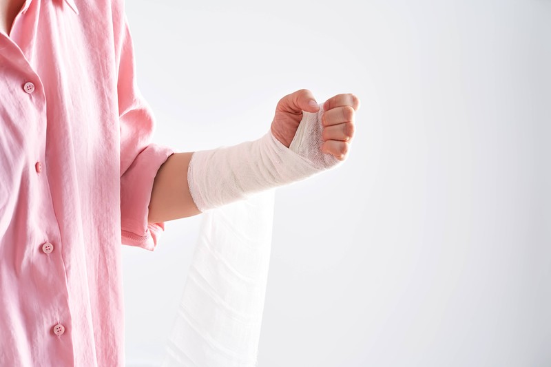 Wenn man eine gebrochene Hand vortäuscht, muss man die Lüge auch länger am Leben erhalten.