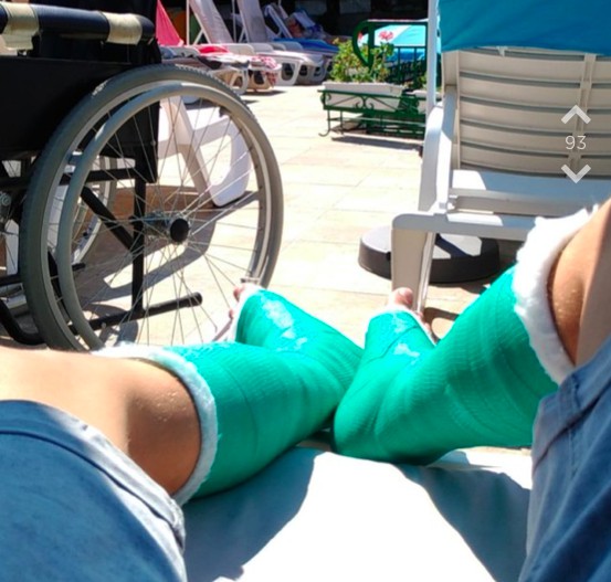 Jodler fällt im Urlaub betrunken vom Balkon und bricht sich beide Beine.