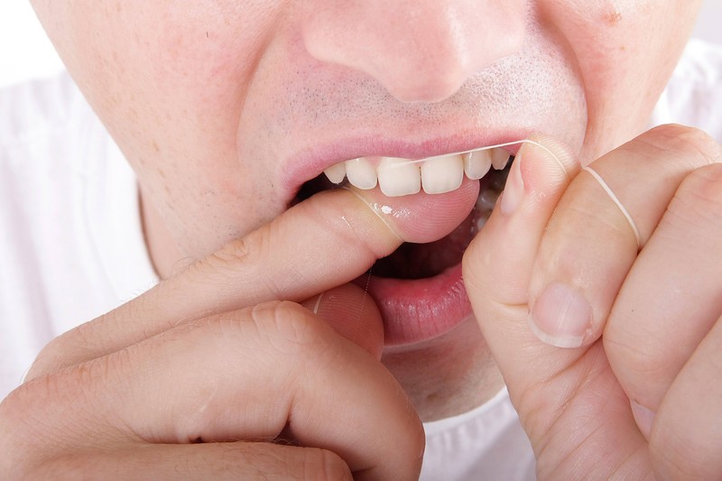 Zahnseide oder Interdentalbürsten sollten täglich verwendet werden, um Entzündungen vorzubeugen.