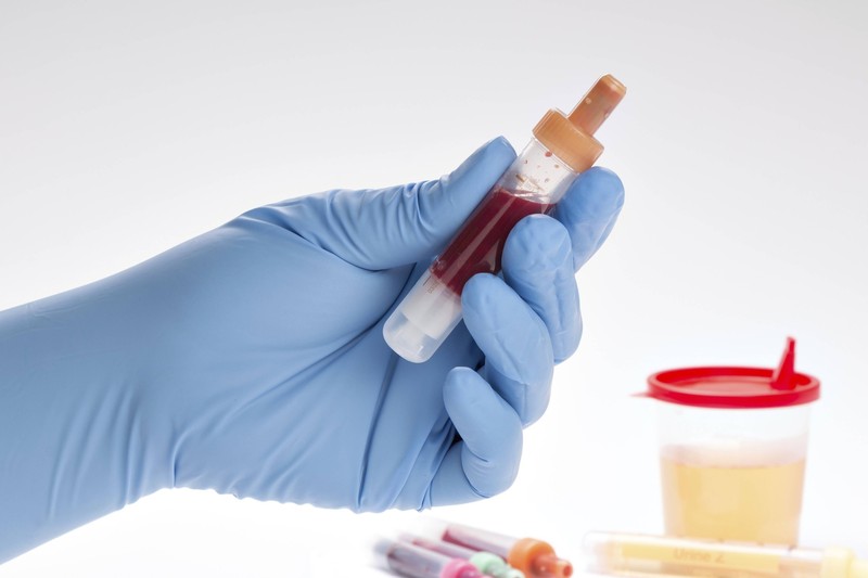 Beim Check-Up vor dem 34. Geburtstag wird das Blut untersucht.